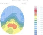 Brainmap